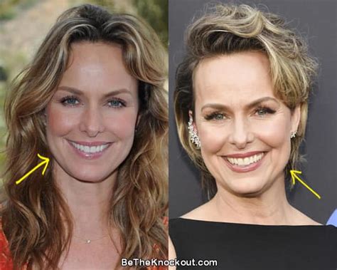 Melora Hardin Plastic Surgery: Boob Job, Botox and Facelift